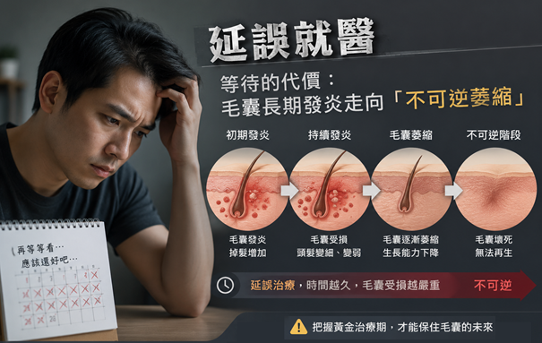 【圓禿、鬼剃頭】會自己好嗎？頭皮禿了一塊別只是觀望，避免毛囊持續萎縮的關鍵在這裡