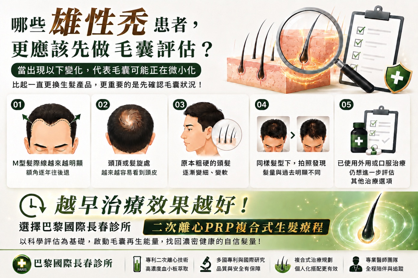 巴黎國際長春診所雄性禿毛囊評估與治療指南示意圖,說明哪些雄性禿患者更應先進行毛囊評估,包括M型髮際線越來越明顯、額角逐年後退、頭頂或髮旋處越來越容易看到頭皮、原本粗硬的頭髮逐漸變細變軟、同樣髮型下拍照發現髮量與過去明顯不同,以及已使用外用或口服治療但仍想進一步評估其他治療選項。圖中搭配毛囊與頭皮剖面、放大鏡檢查、前額髮際線與頭頂稀疏示意,強調雄性禿應及早確認毛囊是否正在微小化,越早治療效果越好,並建議由巴黎國際長春診所評估二次離心PRP複合式生髮療程。