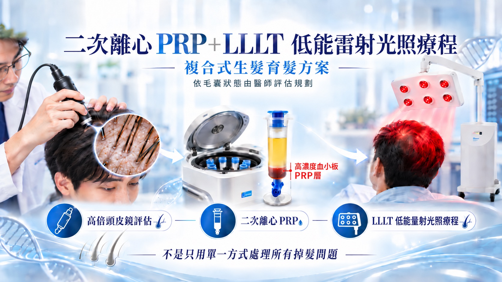 巴黎國際長春診所二次離心PRP加LLLT低能雷射光照療程複合式生髮育髮方案示意圖，呈現醫療級高倍頭皮鏡評估、二次離心PRP製備與LLLT低能雷射光照療程，強調依毛囊狀態由醫師評估規劃。