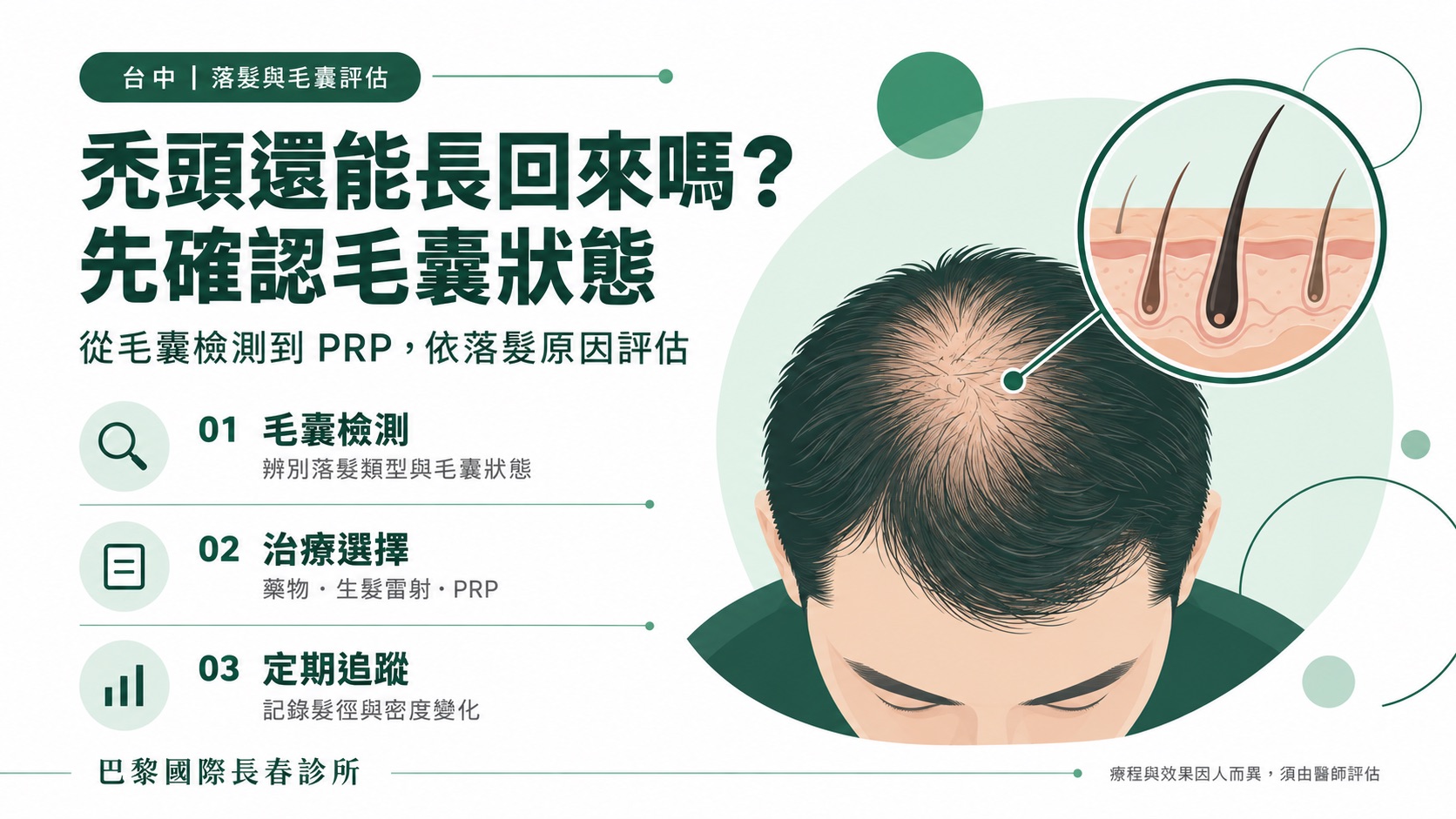 禿頭還能長回來嗎？台中地區禿頭治療，生髮技術從毛囊檢測、治療到PRP一次看